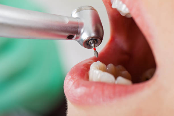 Best Emergency Treatment for Toothache in Southern Shores, NC